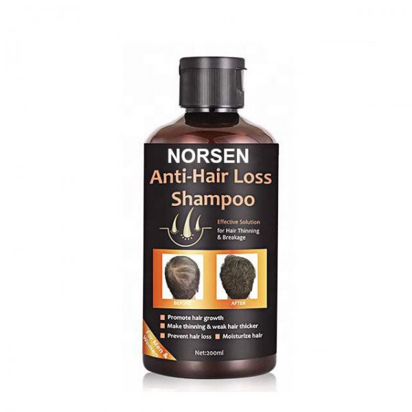 Hot Selling Products Organic Anti-Hair Loss Shampoo For Promote Hair Growth