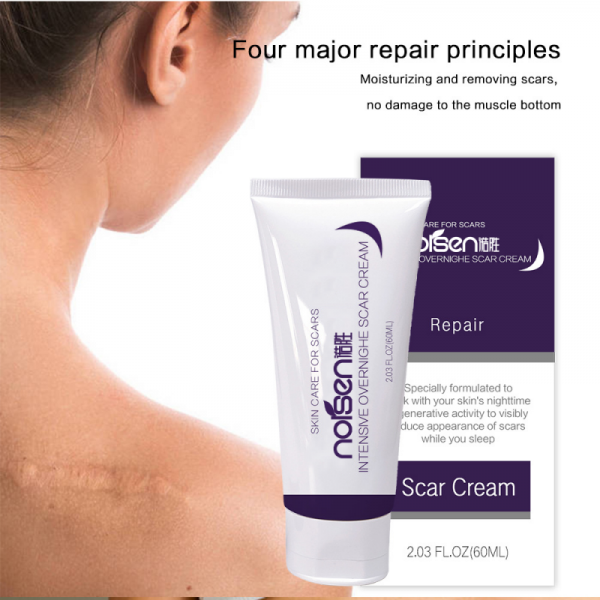 Private Label Organic Deep Scar Removing Treatment Repair Anti Pimples Marks Stretch Cream Acne Stretch Marks Scar Removal Cream