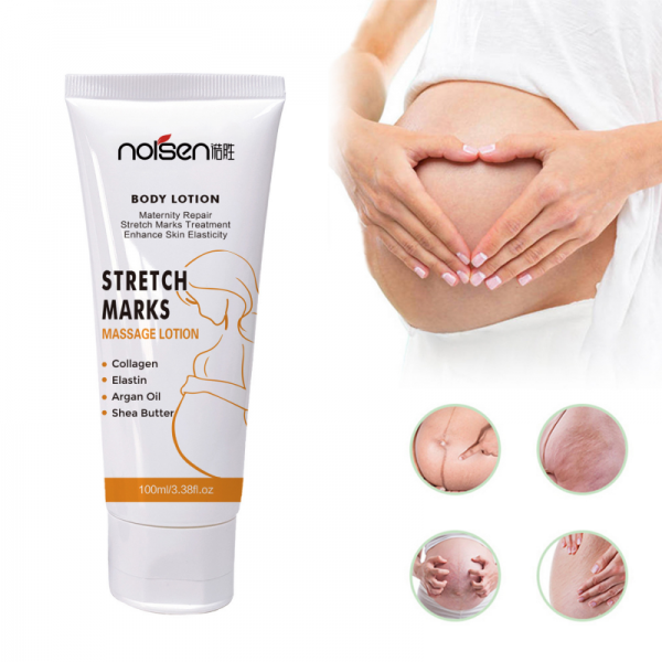 Effective formula Private Label Enhance Skin Elasticity Repair Mango Stretch Marks Cream